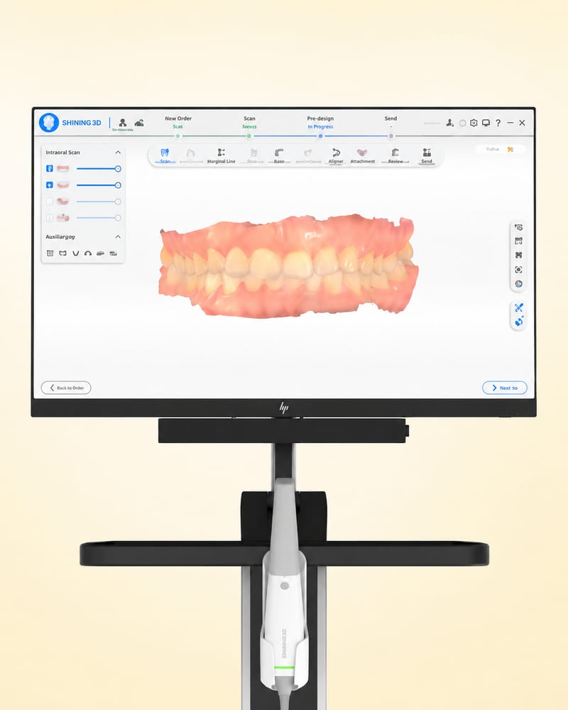 3D Intraoral Scan