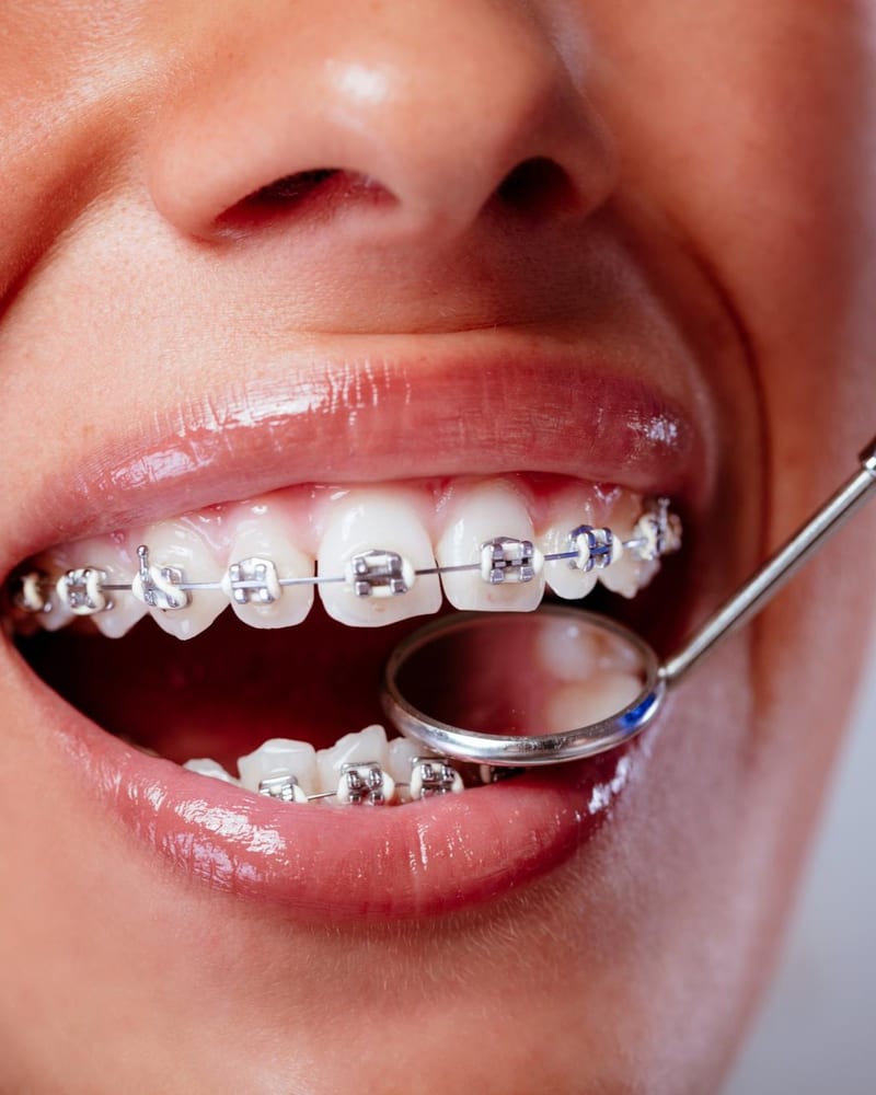 Dentist examining a patient's braces at Alpha Dental, Sutera Utama