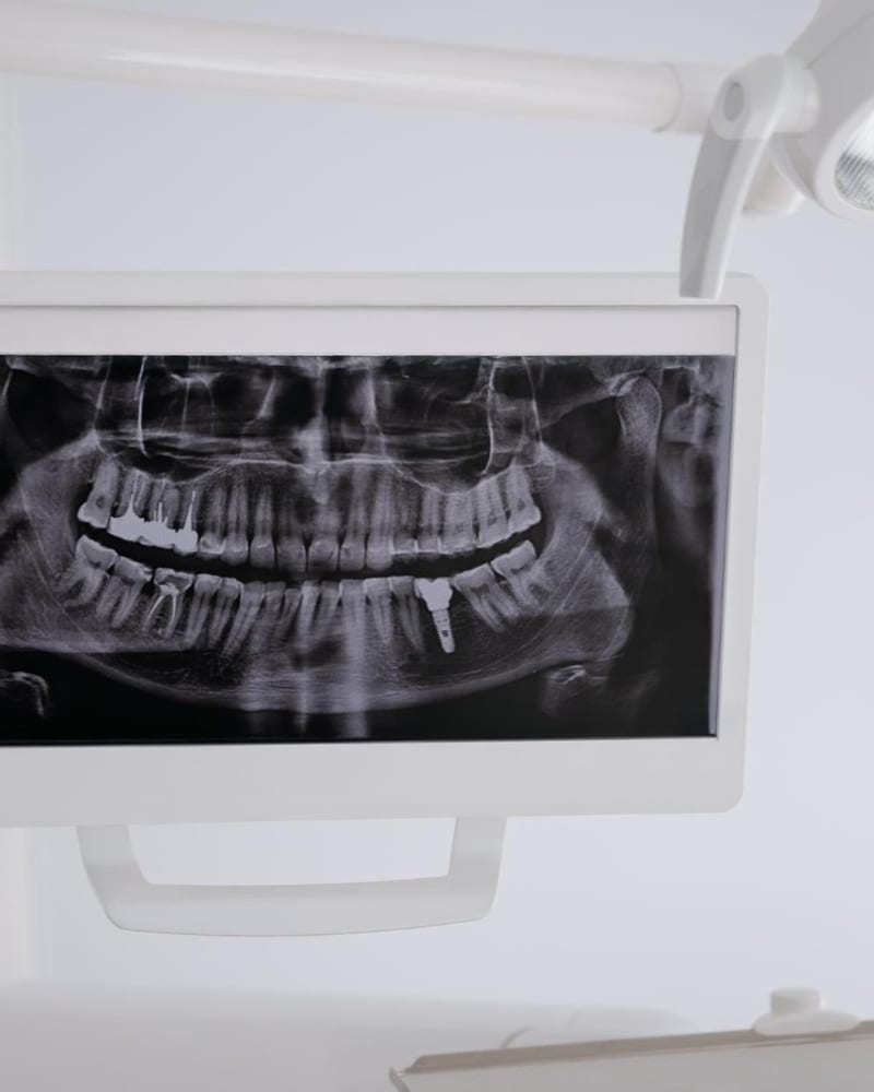 3D X-Ray