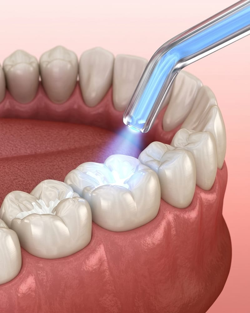 Patient describing discomfort from a lost filling or crown to her dentist at Alpha Dental, Sutera Utama
